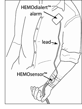 HEMOdialert hemodialysis alarm with HEMOsensor - detect blood leaks HEMOdialert hemodialysis alarm with HEMOsensor - detect blood leaks